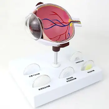 Humanos Catarata Ampliação Olho Anatomia Interna Do Modelo Da Escola De Medicina